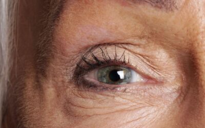 ¿Cuánto tiempo de reposo es necesario después de una cirugía de cataratas?